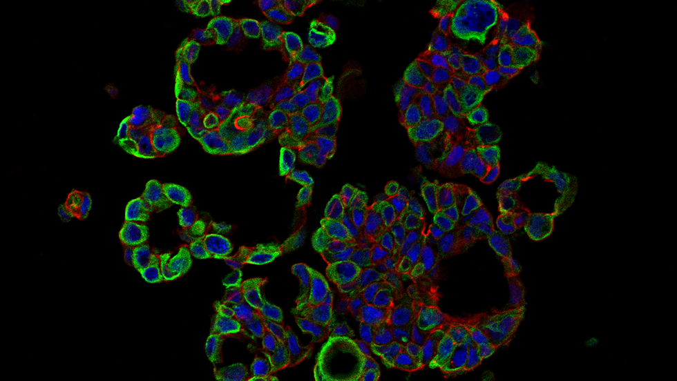 MCF-7 Microtissues