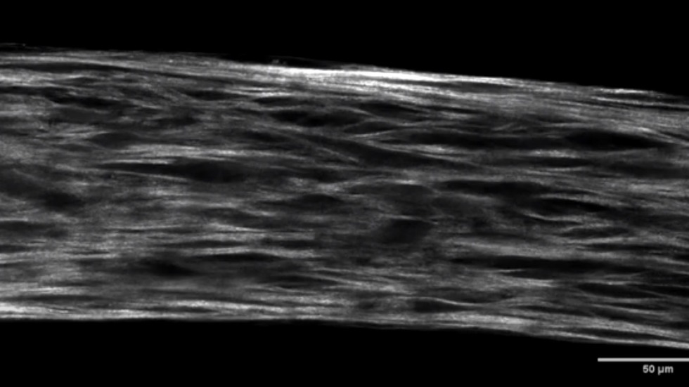 3D imaging of collagen fibers